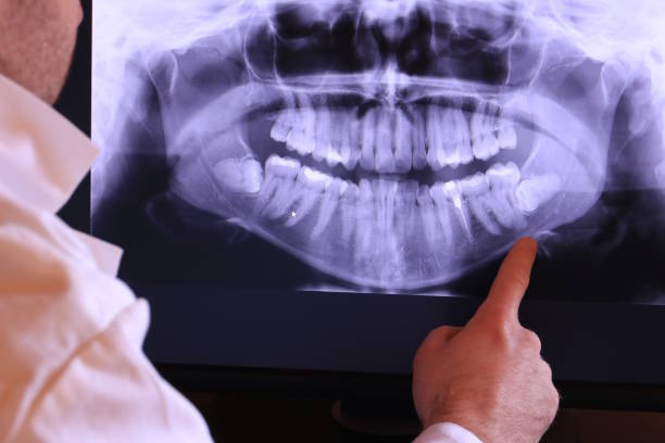Best Emergency Wisdom Tooth Extraction in Vidalia, GA
